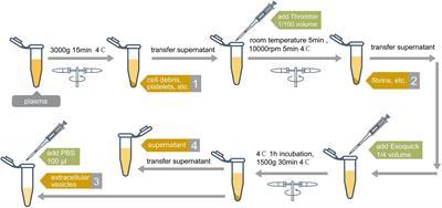 Distinct Extracellular RNA Profiles in Different Plasma Components